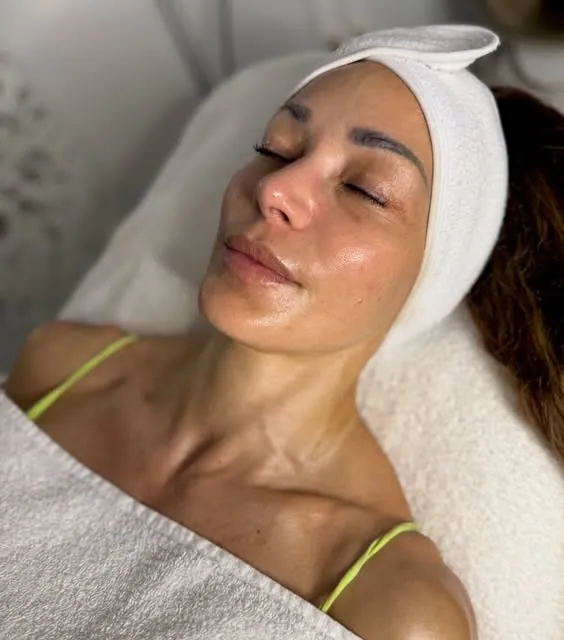 Kundin nach Aquafacial und Microneedling bei SHIREÁ in München